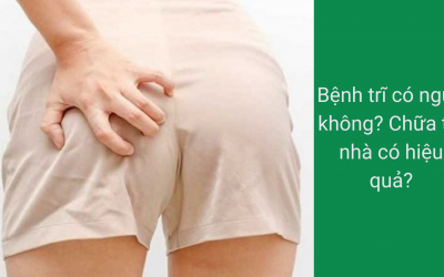 Bệnh trĩ có ngứa không? Chữa tại nhà có hiệu quả?