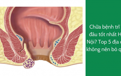 Chữa bệnh trĩ ở đâu tốt nhất Hà Nội? Top 5 địa chỉ không nên bỏ qua