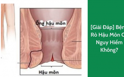 [Giải Đáp] Bệnh Rò Hậu Môn Có Nguy Hiểm Không?