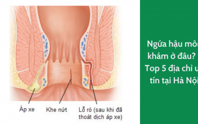Ngứa hậu môn khám ở đâu? – Top 5 địa chỉ uy tín tại Hà Nội