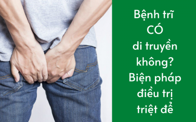 Bệnh trĩ có di truyền không? Biện pháp điều trị triệt để