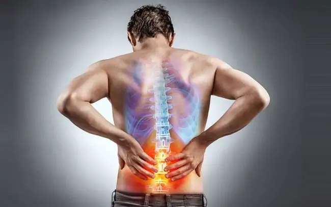 Đau lưng là triệu chứng của bệnh gì?