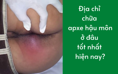 Địa chỉ chữa apxe hậu môn ở đâu tốt nhất hiện nay?
