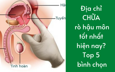 Địa Chỉ Chữa Rò Hậu Môn Ở Đâu Tốt Nhất Hiện Nay? Top 5 Bình Chọn 2023