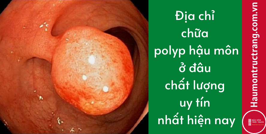 Địa chỉ chữa polyp hậu môn ở đâu chất lượng uy tín nhất hiện nay
