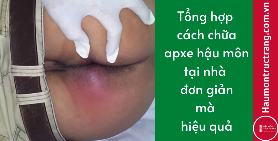 Tổng Hợp] - 18 Cách Chữa Apxe Hậu Môn Tại Nhà Đơn Giản