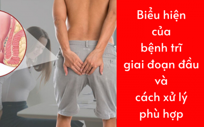 Biểu hiện của bệnh trĩ giai đoạn đầu và cách xử lý phù hợp