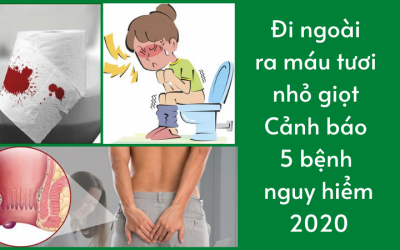 { Đi Ngoài Ra Máu Tươi Nhỏ Giọt } – Danh Sách 5 Nên Cần Lưu Ý