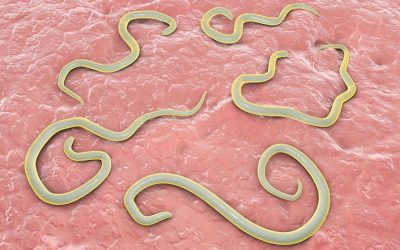 Giun kim gây ngứa hậu môn chớ coi thường [Cảnh báo]