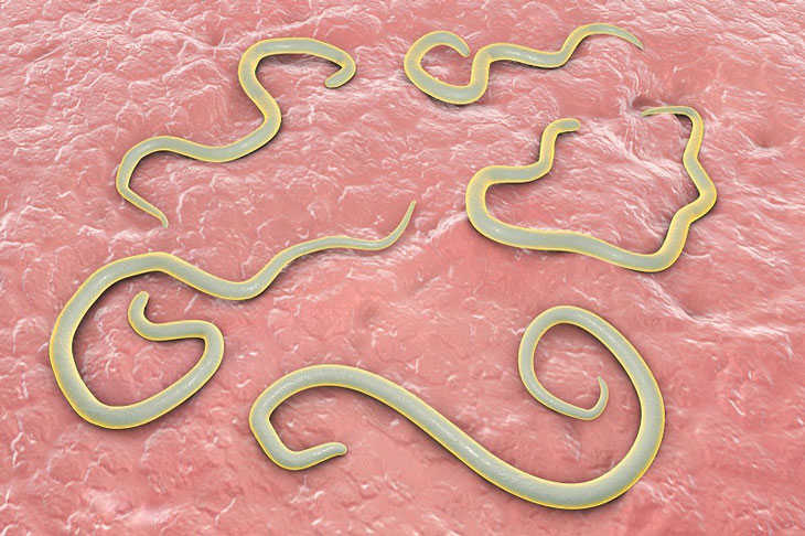 Giun kim gây ngứa hậu môn chớ coi thường [Cảnh báo]