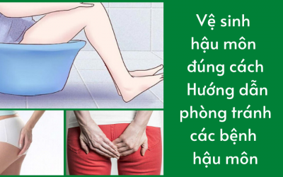 {Vệ sinh hậu môn đúng cách} Hướng dẫn phòng tránh các bệnh hậu môn