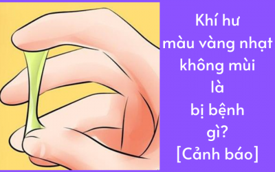 Khí hư màu vàng nhạt không mùi là bị bệnh gì? [Cảnh báo]