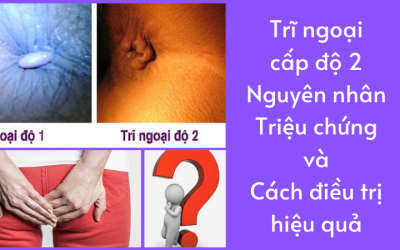 [ Trĩ Ngoại Cấp Độ 2 ] – Nguyên Nhân, Dấu Hiệu Và Điều Trị Tại Nhà