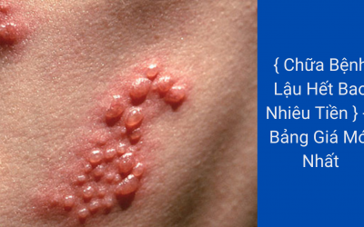 { Chữa Bệnh Lậu Hết Bao Nhiêu Tiền } –  Bảng Giá Mới Nhất