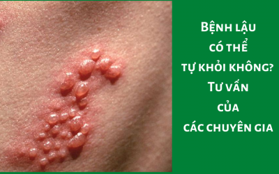 Bệnh lậu có thể tự khỏi không? [Tư vấn của các chuyên gia]