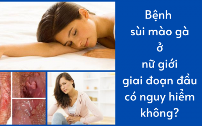 Bệnh sùi mào gà ở nữ giới giai đoạn đầu có nguy hiểm không?