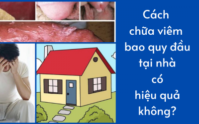 Cách chữa viêm bao quy đầu tại nhà có hiệu quả không?