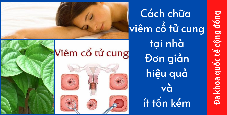 Cách chữa viêm cổ tử cung tại nhà: Đơn giản, hiệu quả và ít tốn kém
