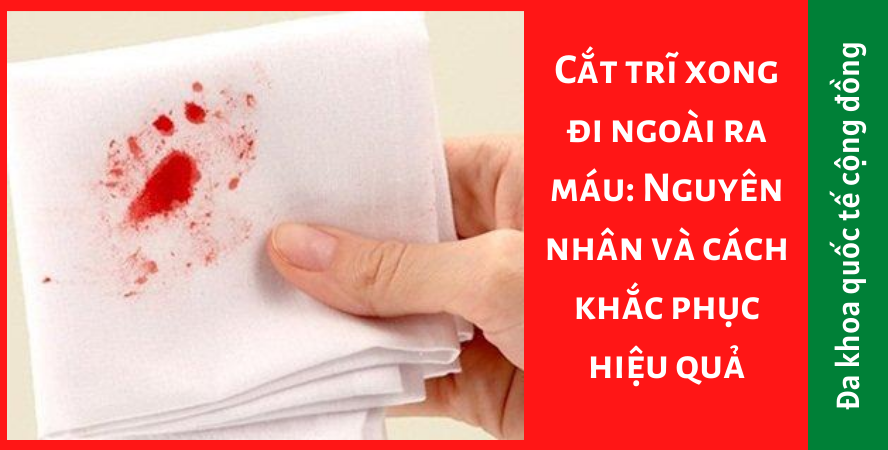 Cắt trĩ xong đi ngoài ra máu: Nguyên nhân và cách khắc phục hiệu quả