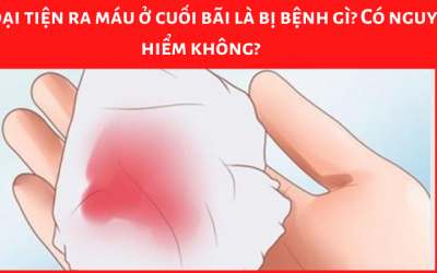 Đi đại tiện ra máu ở cuối bãi là bị bệnh gì? Có nguy hiểm không?