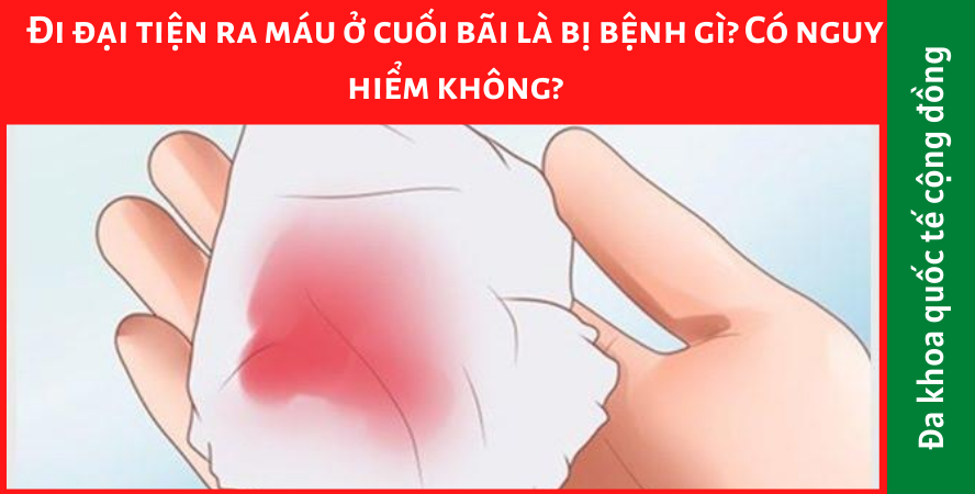 Đi đại tiện ra máu ở cuối bãi là bị bệnh gì? Có nguy hiểm không?