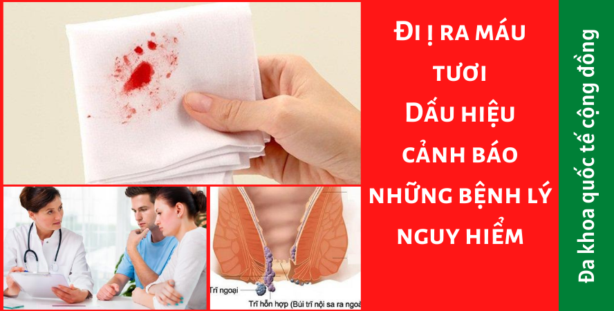 Đi ị ra máu tươi: Dấu hiệu cảnh báo những bệnh lý nguy hiểm
