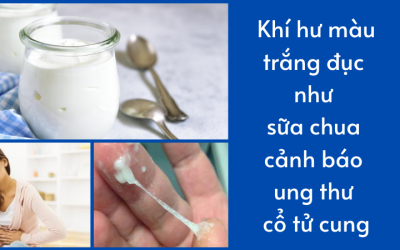 Khí hư màu trắng đục như sữa chua cảnh báo ung thư cổ tử cung