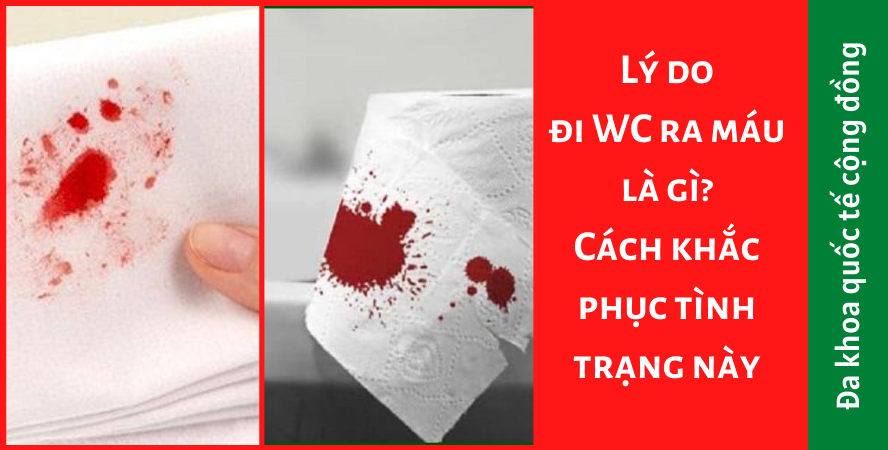 Lý do đi WC ra máu là gì? Cách khắc phục tình trạng này