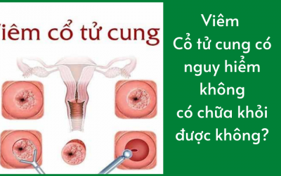 Viêm cổ tử cung có nguy hiểm không, có chữa khỏi được không?