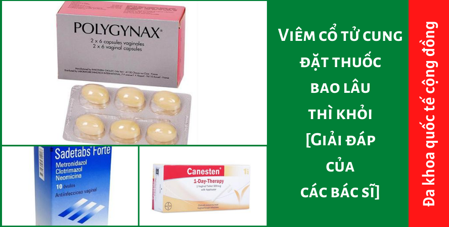 Viêm cổ tử cung đặt thuốc bao lâu thì khỏi [Giải đáp của các bác sĩ]