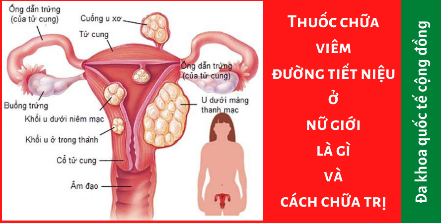 Thuốc chữa viêm đường tiết niệu ở nữ giới là gì và cách chữa trị ...