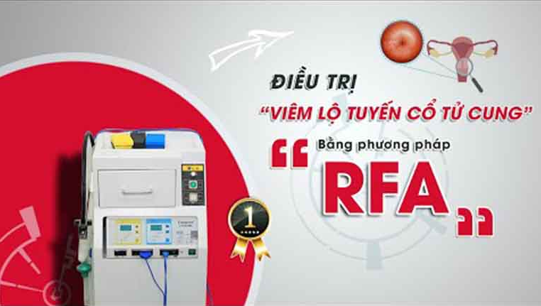 Công nghệ RFA điều trị viêm lộ tuyến - phương pháp hiện đại, hiệu quả