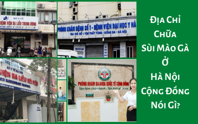 Địa Chỉ Chữa Sùi Mào Gà Ở Hà Nội – Cộng Đồng Nói Gì?