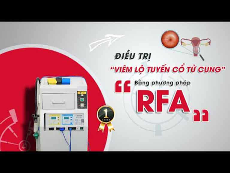 Phương pháp RFA chữa viêm lộ tuyến