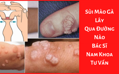 Sùi Mào Gà Lây Qua Đường Nào? – Bác Sĩ Nam Khoa Tư Vấn