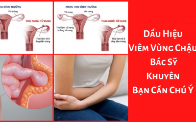 Dấu Hiệu Viêm Vùng Chậu – Bác Sỹ Khuyên Bạn Cần Chú Ý