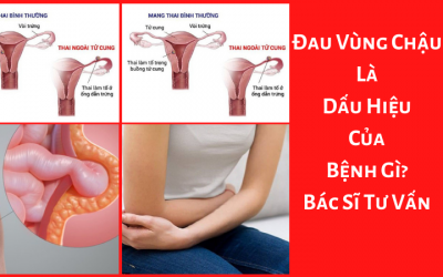 Đau Vùng Chậu Là Dấu Hiệu Của Bệnh Gì?- Bác Sĩ Chuyên Khoa Tư Vấn