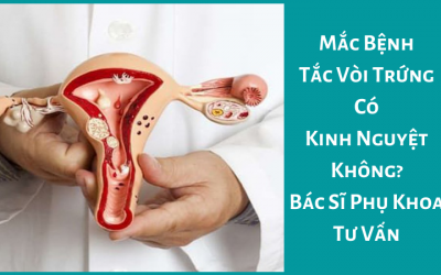 Dấu Hiệu Tắc Vòi Trứng – Bác Sĩ Phụ Sản Tư Vấn Chi Tiết