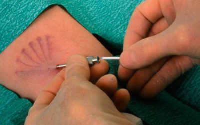 [ Cấy que tránh thai ở Hà Nội ] – Danh sách 10 cơ sở uy tín