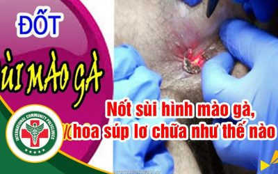 Gói khám sùi mào gà 5 hạng mục chỉ 950K (Giá gốc 2050k)