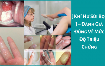 [ Khí Hư Sủi Bọt ] – Đánh Giá Đúng Về Mức Độ Triệu Chứng