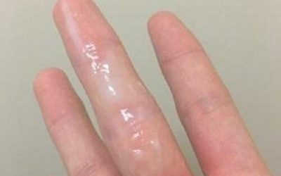 Khí Hư Có Mùi Hôi Nhưng Không Ngứa Là Như Thế Nào?