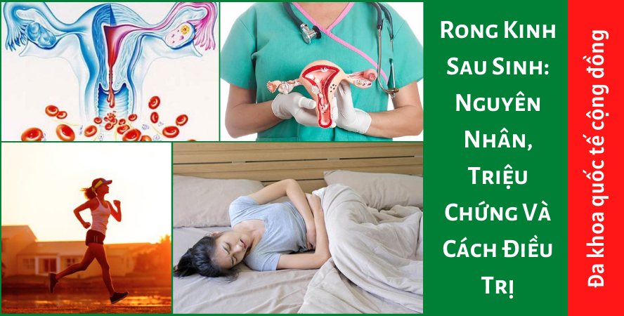 Rong Kinh Sau Sinh: Nguyên Nhân, Triệu Chứng Và Cách Điều Trị