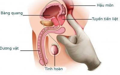 Khám Tiền Liệt Tuyến Ở Đâu Tốt – Top 5 Địa Chỉ Tốt Ở Hà Nội