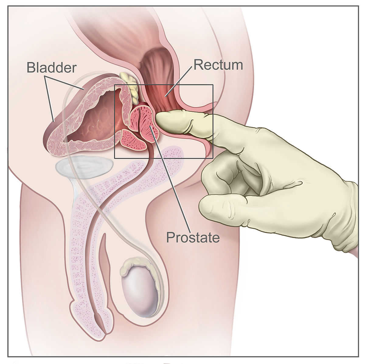 Khám trực tràng bằng ngón tay(digital rectal exam (DRE))