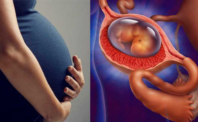 Phá thai, sẩy thai hoặc mang thai ngoài tử cung