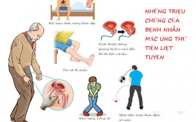 Dấu Hiệu Ung Thư Tuyến Tiền Liệt – Cách Phát Hiện Và Điều Trị?