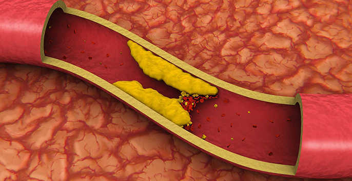 Hạt sen có tác dụng điều hòa cholesterol và đường huyết trong cơ thể