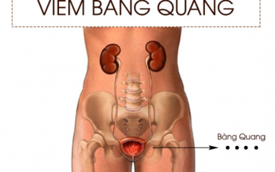 Viêm bàng quang nên ăn gì, kiêng ăn gì mau khỏi bệnh?