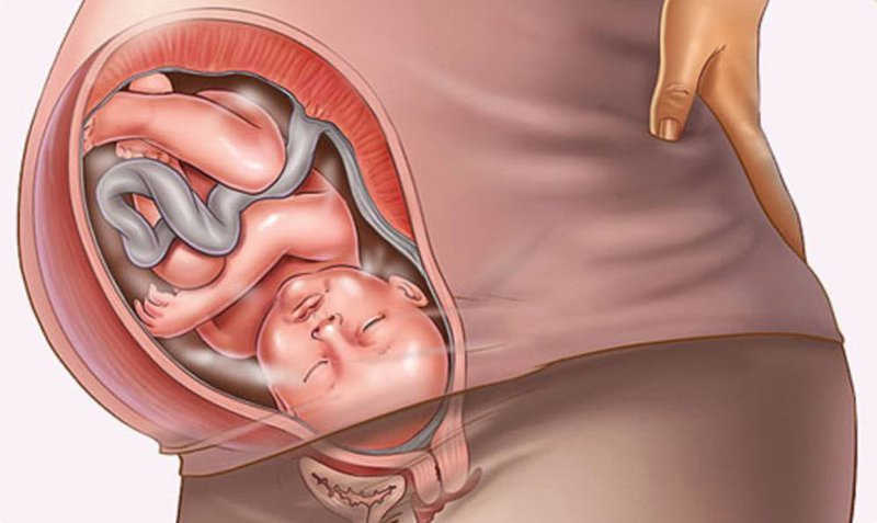Nguyên nhân của nấm âm đạo khi mang thai là gì? 